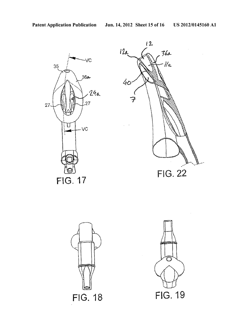 LARYNGEAL MASK AIRWAY DEVICE - diagram, schematic, and image 16