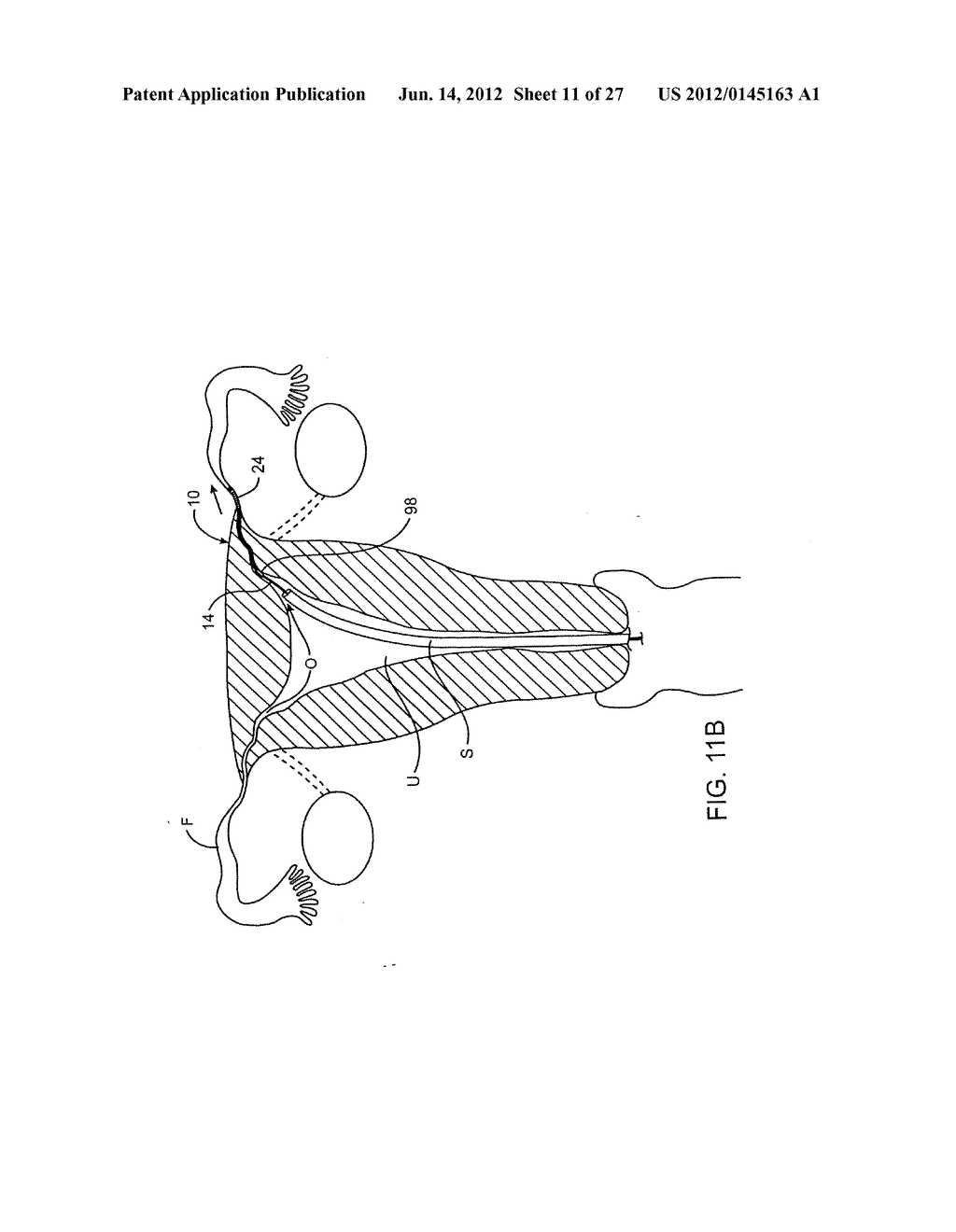 DEPLOYMENT ACTUATION SYSTEM - diagram, schematic, and image 12