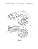 Intra-oral mandibular advancement appliance diagram and image