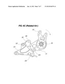 APPARATUS FOR PREVENTING NECK INJURY FOR USE IN VEHICLE SEAT diagram and image