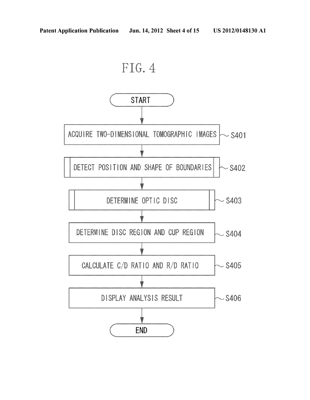 IMAGE PROCESSING APPARATUS FOR PROCESSING TOMOGRAPHIC IMAGE OF SUBJECT'S     EYE, IMAGING SYSTEM, METHOD FOR PROCESSING IMAGE, AND RECORDING MEDIUM - diagram, schematic, and image 05