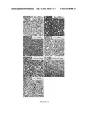 Targeting Kidney Mesangium With Nanoparticles of Defined Diameter diagram and image