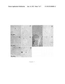 Targeting Kidney Mesangium With Nanoparticles of Defined Diameter diagram and image