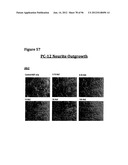 ANTI-NGF COMPOSITIONS AND USE THEREOF diagram and image