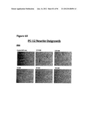 ANTI-NGF COMPOSITIONS AND USE THEREOF diagram and image