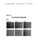 ANTI-NGF COMPOSITIONS AND USE THEREOF diagram and image