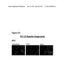 ANTI-NGF COMPOSITIONS AND USE THEREOF diagram and image