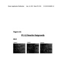 ANTI-NGF COMPOSITIONS AND USE THEREOF diagram and image