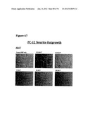 ANTI-NGF COMPOSITIONS AND USE THEREOF diagram and image