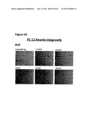 ANTI-NGF COMPOSITIONS AND USE THEREOF diagram and image