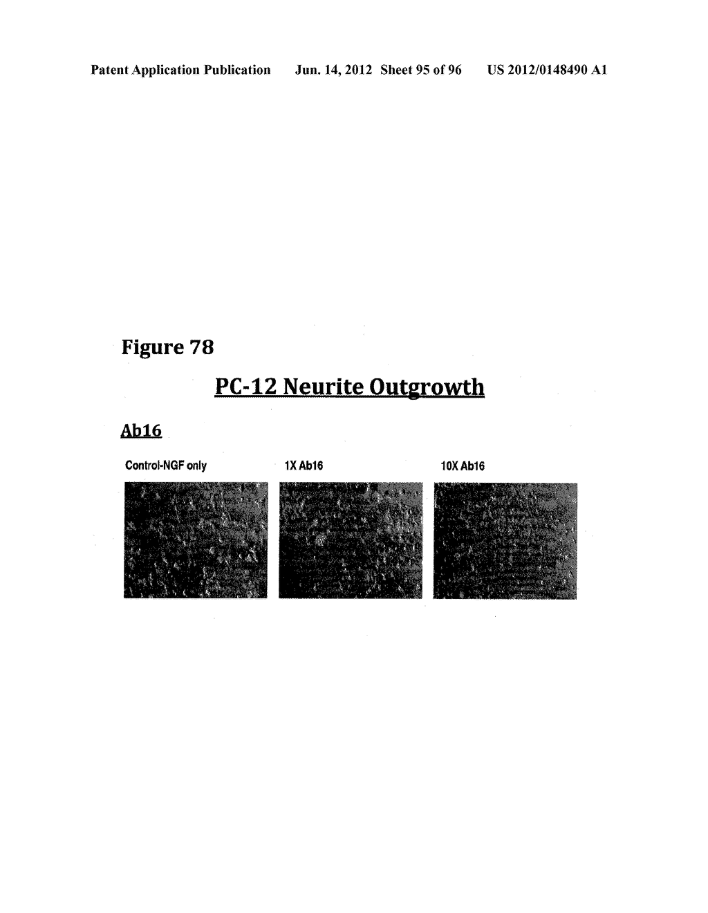 ANTI-NGF COMPOSITIONS AND USE THEREOF - diagram, schematic, and image 96