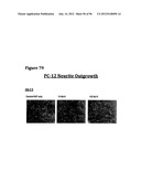 ANTI-NGF COMPOSITIONS AND USE THEREOF diagram and image