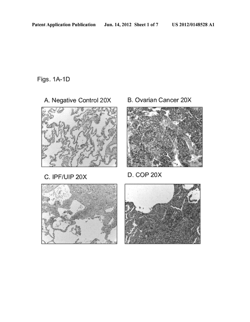 COMPOSITIONS AND METHODS TO INDUCE TARGETED APOPTOSIS - diagram, schematic, and image 02