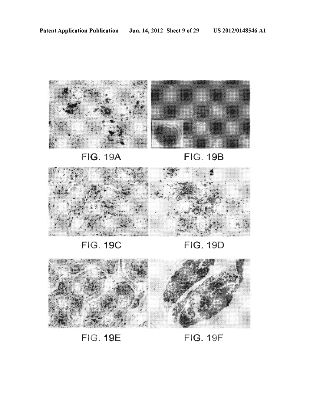 PERICYTE PROGENITOR CELLS AND METHODS OF GENERATING AND USING SAME - diagram, schematic, and image 10