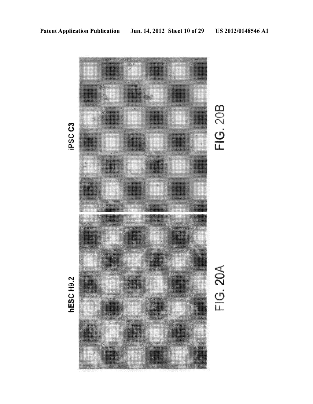 PERICYTE PROGENITOR CELLS AND METHODS OF GENERATING AND USING SAME - diagram, schematic, and image 11