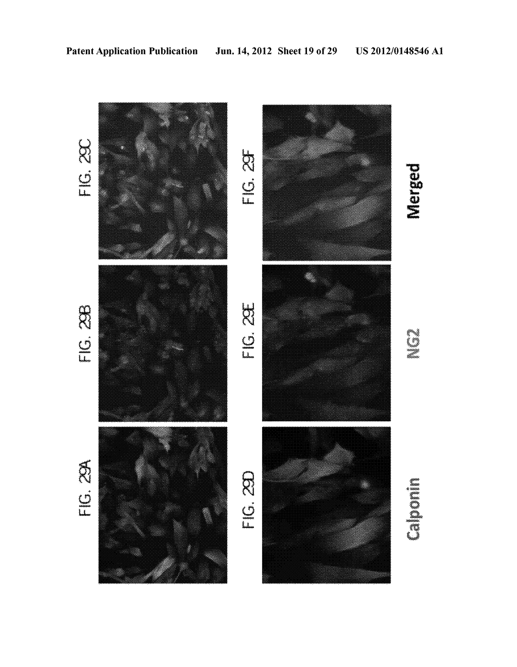 PERICYTE PROGENITOR CELLS AND METHODS OF GENERATING AND USING SAME - diagram, schematic, and image 20