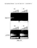 COMPOSITIONS AND METHODS FOR THE DIAGNOSIS AND TREATMENT OF IMMUNE     DISORDERS diagram and image