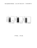 COMPOSITIONS AND METHODS FOR THE DIAGNOSIS AND TREATMENT OF IMMUNE     DISORDERS diagram and image