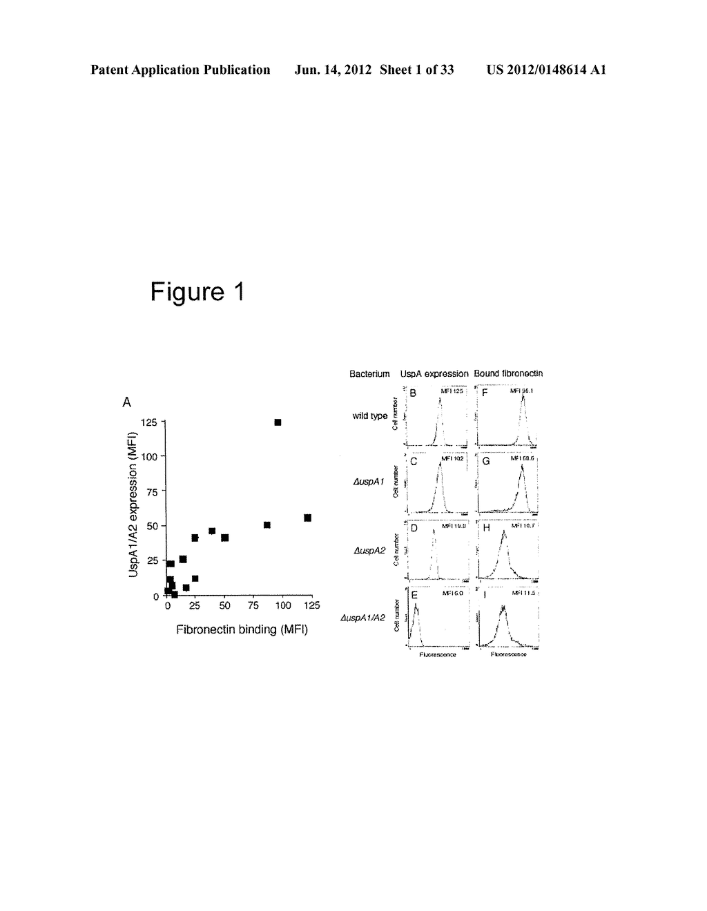 Interaction of Moraxella Catarrhalis with Epithelial Cells, Extracellular     Matrix Proteins and the Complement System - diagram, schematic, and image 02