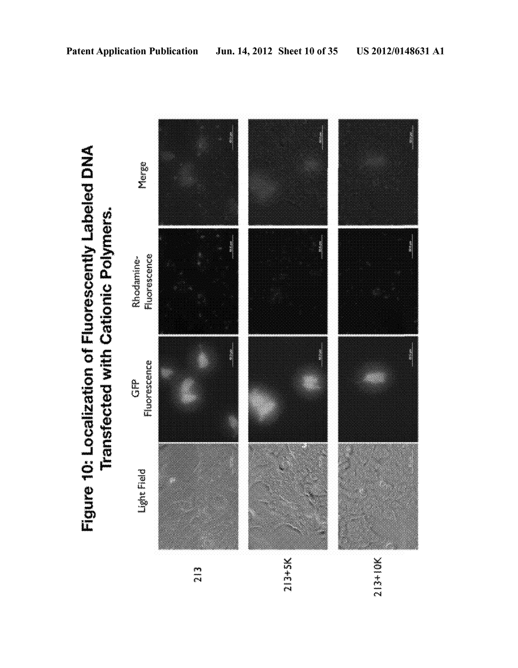 PEGYLATED POLYPLEXES FOR POLYNUCLEOTIDE DELIVERY - diagram, schematic, and image 11