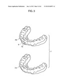 ORTHODONTIC APPLIANCE diagram and image