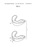 ORTHODONTIC APPLIANCE diagram and image