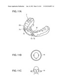 ORTHODONTIC APPLIANCE diagram and image