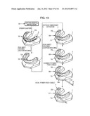 ORTHODONTIC APPLIANCE diagram and image