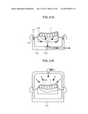 ORTHODONTIC APPLIANCE diagram and image