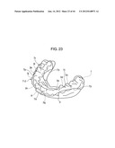 ORTHODONTIC APPLIANCE diagram and image