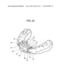 ORTHODONTIC APPLIANCE diagram and image