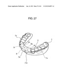 ORTHODONTIC APPLIANCE diagram and image