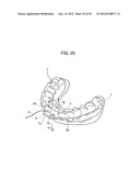 ORTHODONTIC APPLIANCE diagram and image