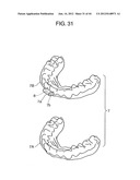 ORTHODONTIC APPLIANCE diagram and image