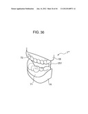 ORTHODONTIC APPLIANCE diagram and image