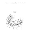 ORTHODONTIC APPLIANCE diagram and image