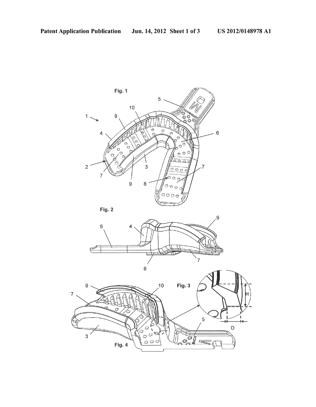 Impression Tray - diagram, schematic, and image 02