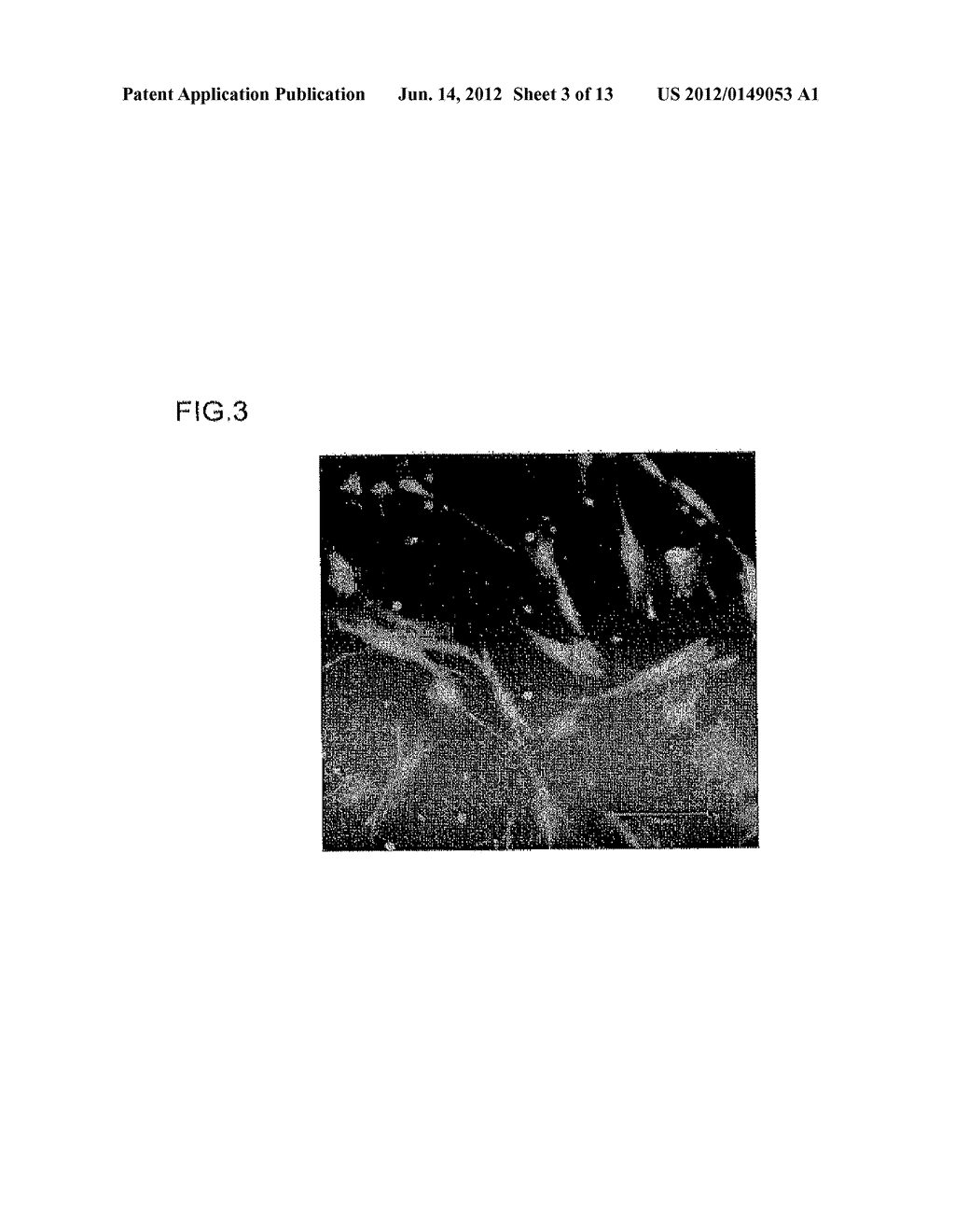 CARRIER PEPTIDE FRAGMENT AND USE THEREOF - diagram, schematic, and image 04