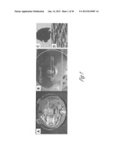 METHOD FOR DETECTING NUCLEATED CELLS diagram and image