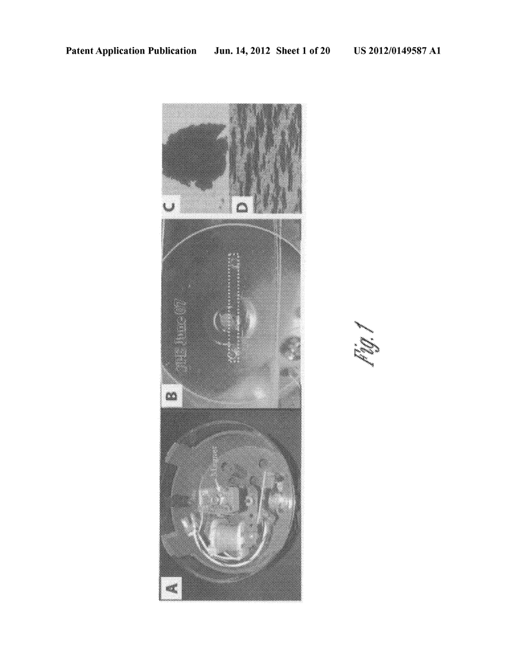 METHOD FOR DETECTING NUCLEATED CELLS - diagram, schematic, and image 02