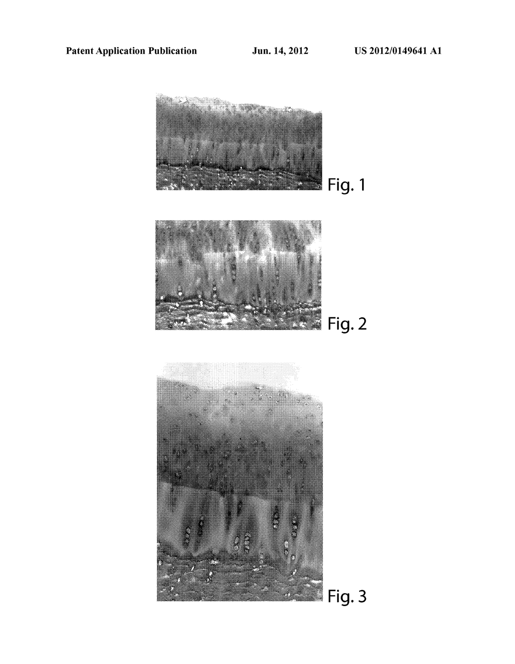 Methods and Compositions for Regenerating Articular Cartilage - diagram, schematic, and image 02