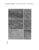 TRICYCLO-DNA ANTISENSE OLIGONUCLEOTIDES, COMPOSITIONS, AND METHODS FOR THE     TREATMENT OF DISEASE diagram and image