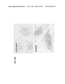 TRICYCLO-DNA ANTISENSE OLIGONUCLEOTIDES, COMPOSITIONS, AND METHODS FOR THE     TREATMENT OF DISEASE diagram and image