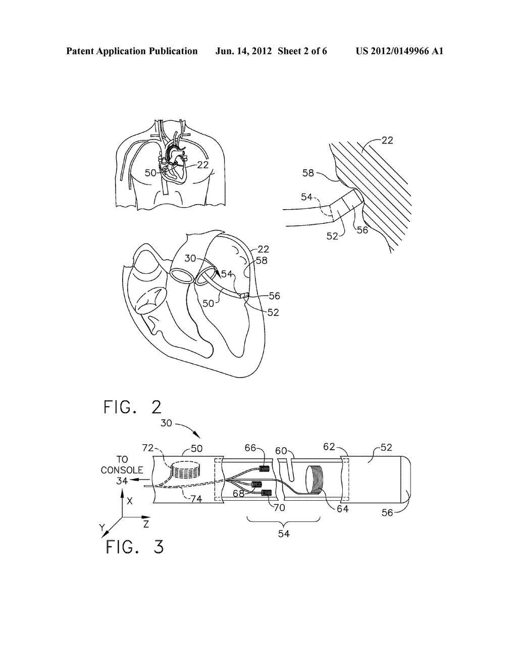 SYSTEM AND METHOD FOR DETECTION OF METAL DISTURBANCE BASED ON CONTACT     FORCE MEASUREMENT - diagram, schematic, and image 03