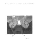 IMPLANTABLE DEVICES FOR THE TREATMENT OF INCONTINENCE AND METHODS OF USING     SAME diagram and image