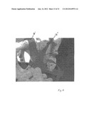 IMPLANTABLE DEVICES FOR THE TREATMENT OF INCONTINENCE AND METHODS OF USING     SAME diagram and image