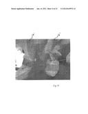 IMPLANTABLE DEVICES FOR THE TREATMENT OF INCONTINENCE AND METHODS OF USING     SAME diagram and image