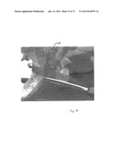 IMPLANTABLE DEVICES FOR THE TREATMENT OF INCONTINENCE AND METHODS OF USING     SAME diagram and image