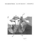 IMPLANTABLE DEVICES FOR THE TREATMENT OF INCONTINENCE AND METHODS OF USING     SAME diagram and image