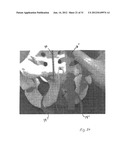 IMPLANTABLE DEVICES FOR THE TREATMENT OF INCONTINENCE AND METHODS OF USING     SAME diagram and image